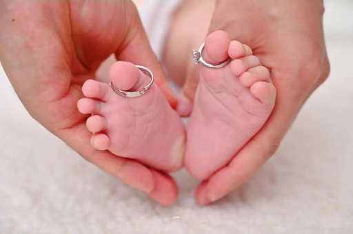 汶上孕妇怎样预防妊娠纹